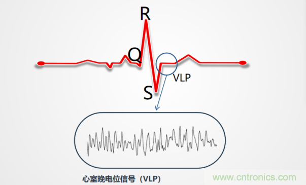 解決心電監(jiān)測(cè)行業(yè)難題，曼森伯格的濾波技術(shù)獲國(guó)家知識(shí)產(chǎn)權(quán)局發(fā)明授權(quán)